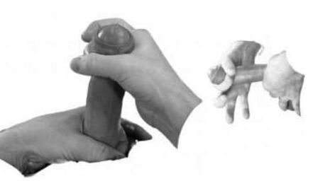 Distorsione del pene per aumentarlo